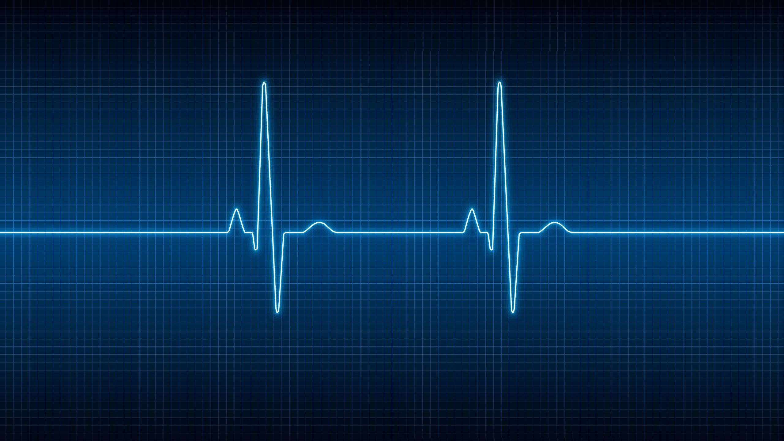 Пульс остановился. Кардиограмма остановки сердца. Остановка сердца на ЭКГ. Пульс остановка сердца.